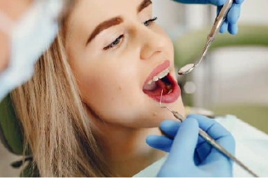 Accessing the tooth's pulp chamber during the root canal procedure at Amazing Family Dental, allowing for the removal of infected tissue.